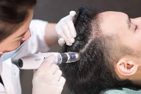 Mesotherapy